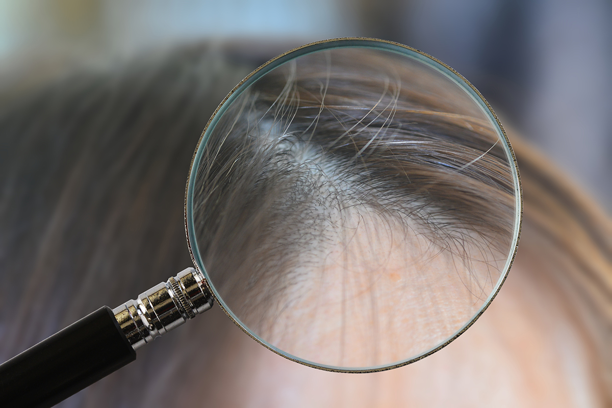 「白髪を抜くと増える」？髪と頭皮5つのウソとホント 記事詳細｜Infoseekニュース