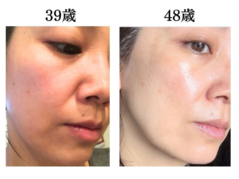 48歳の今より30代半ばのほうが断然老け肌だった。やめてよかった生活習慣残りの2つは？