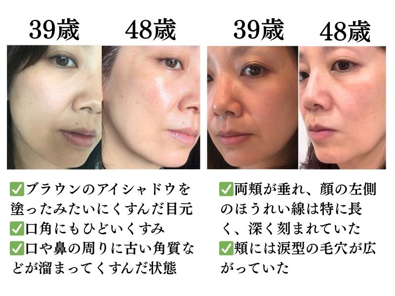 1番対策が難しかった…！頬のたるみやほうれい線につながるNG食事習慣最後のひとつ