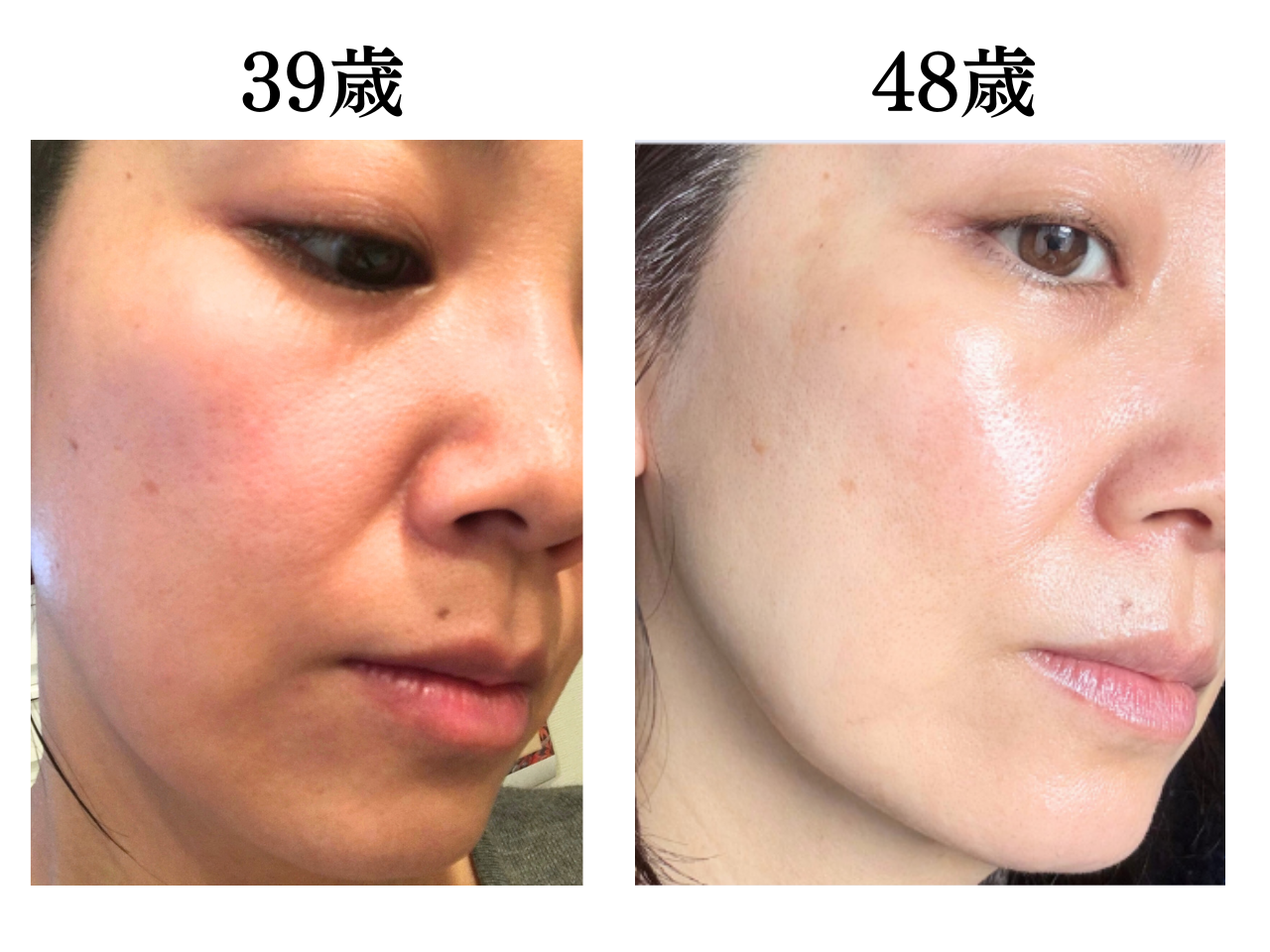 これやると心から老ける！肌年齢マイナス14歳になった美容のプロがやめて良かった美容3つ